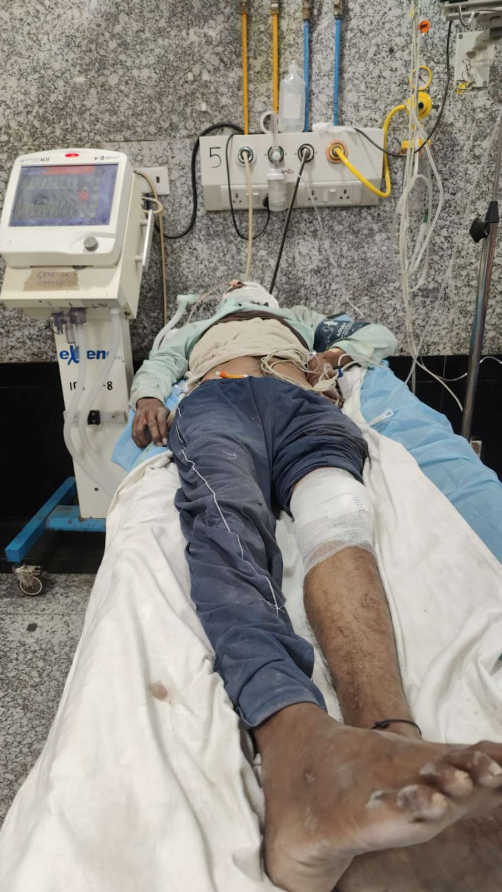 Kashi Ki Aawaz | चंदौली में बंदरों के आतंक से युवक की मौत ।